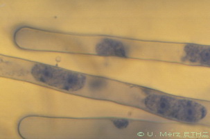 root hairs with young plasmodia