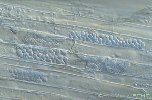 root epidermal cells with zoosporangia