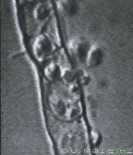 zoosporangium with emerging zoospores