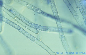 root hairs with empty zoosporangia