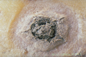 typical powdery scab lesion