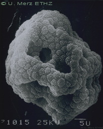 EM micrograph of spore ball
